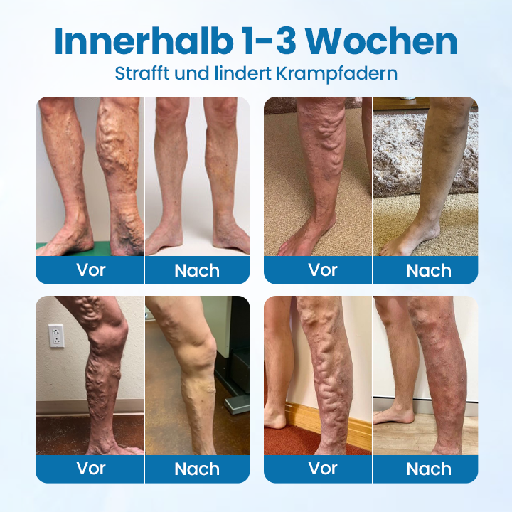 Timilk® VeinGuard Kräuterspray