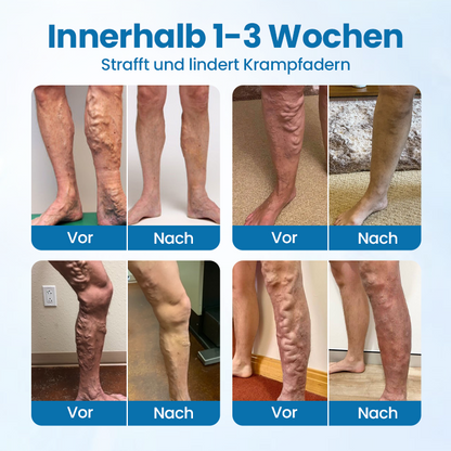 Timilk® VeinGuard Kräuterspray