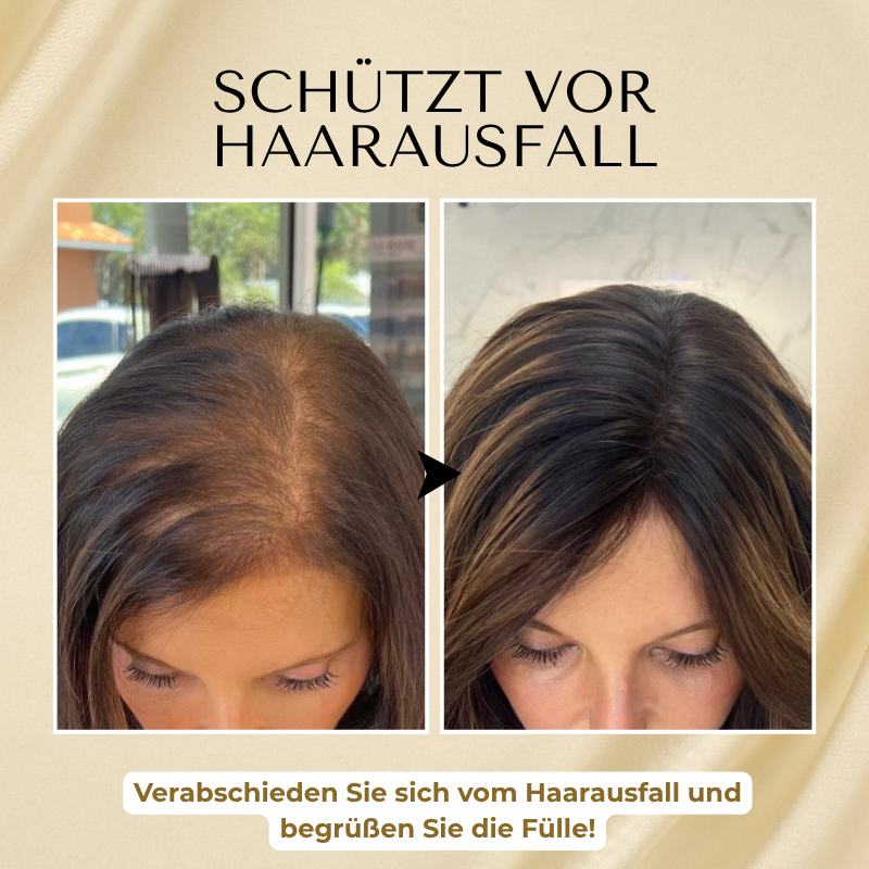 Timilk® VitaStrand Biotin Haarwachstumsspray-
