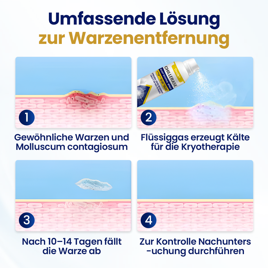 Timilk® ChillErase Erneuerungs-Spray gegen Hautunreinheiten ⚕️