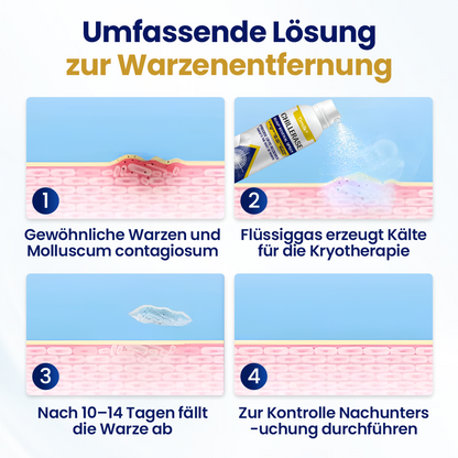 Timilk® ChillErase Erneuerungs-Spray gegen Hautunreinheiten ⚕️