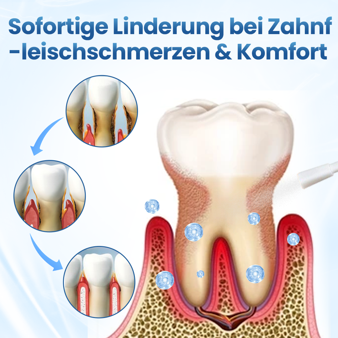 Timilk® GumRelief Natürliches Spray🔥