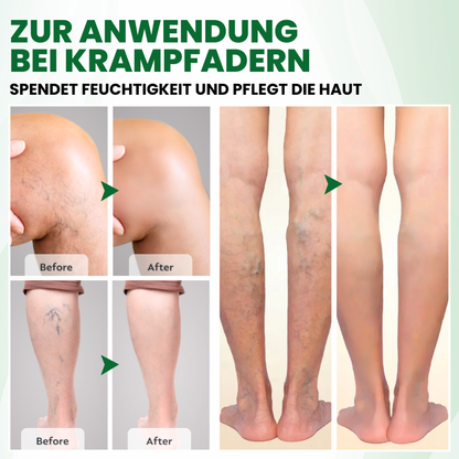Timilk® VariPoint™ Phyto-Vaskuläres Mikronadel-Pflaster