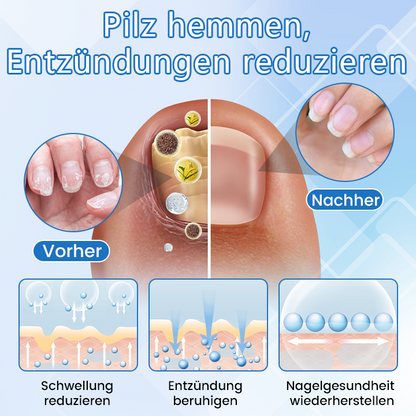 ✅ Offizieller Shop: Timilk® DermaMag Magnesium-Reparaturspray 🔥 FDA-zertifiziert (klinisch nachgewiesene Linderung bei Psoriasis, Ekzemen und chronischen Hautirritationen 🌿)