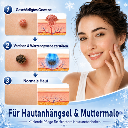 Ceoerty® CryoClear Pro Hauterneuerungs-Spray gegen Hautunebenheiten
