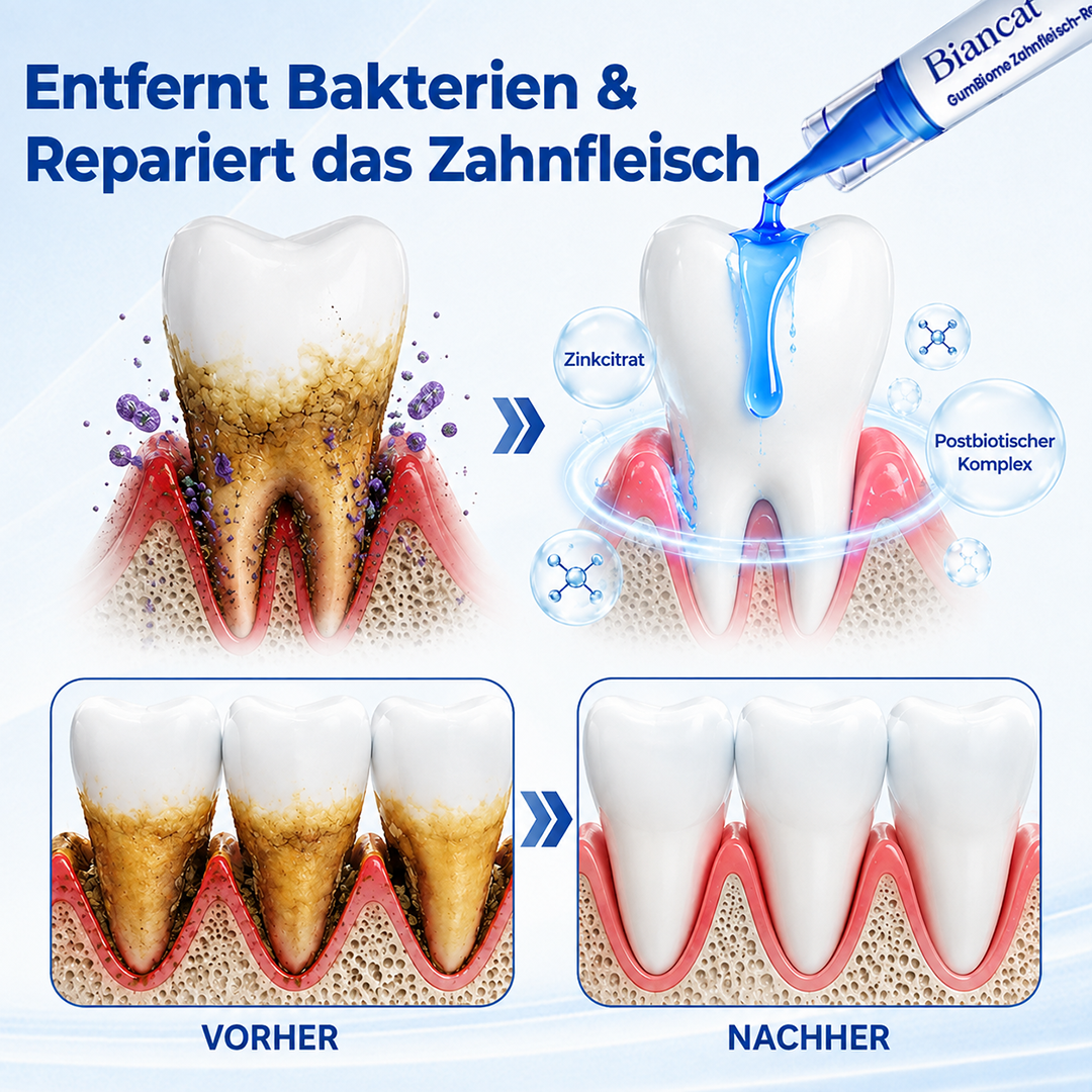 Biancat® GumBiome Zahnfleisch-Regenerationsgel
