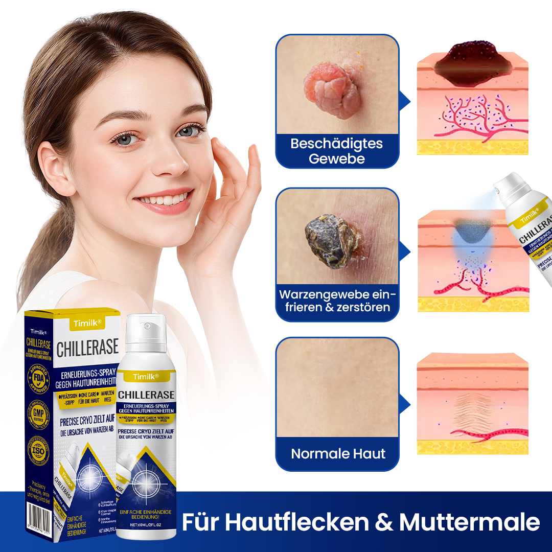 Timilk® ChillErase Erneuerungs-Spray gegen Hautunreinheiten ⚕️
