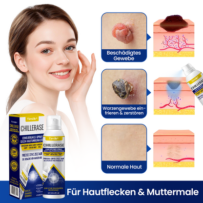 Timilk® ChillErase Erneuerungs-Spray gegen Hautunreinheiten ⚕️