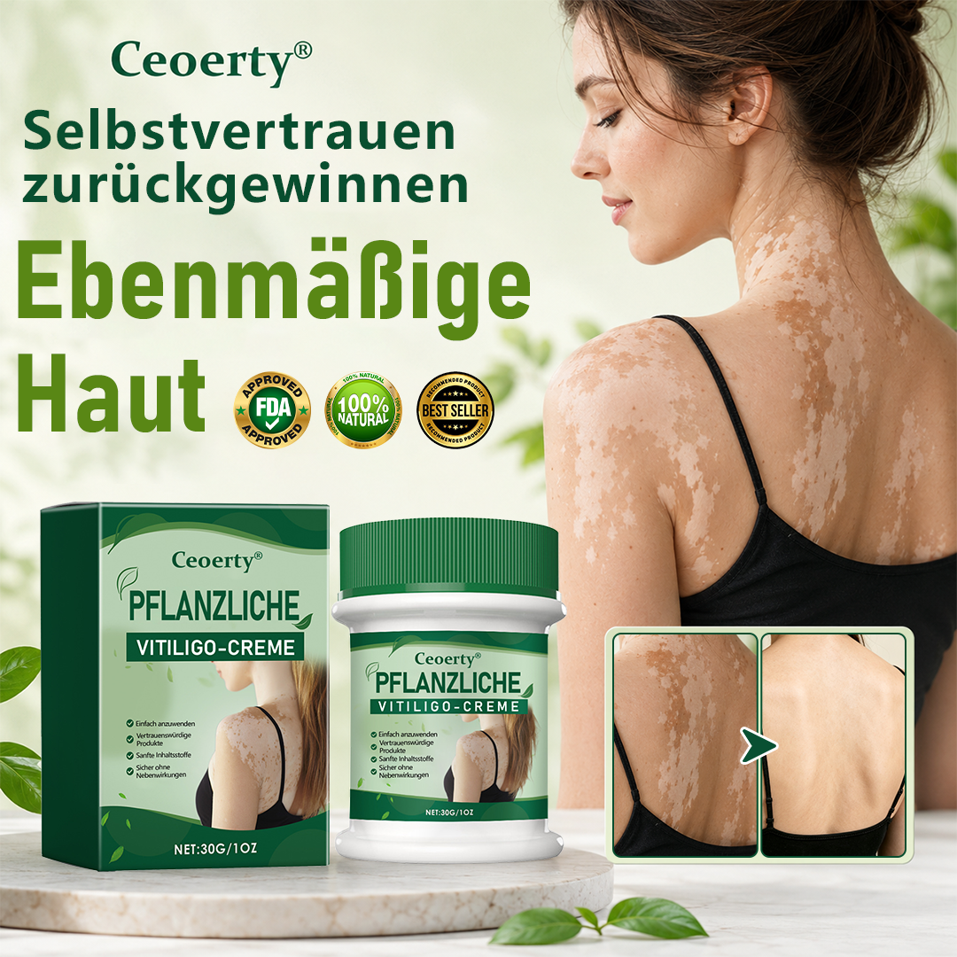 Ceoerty® Kräuter-Vitiligo-Creme