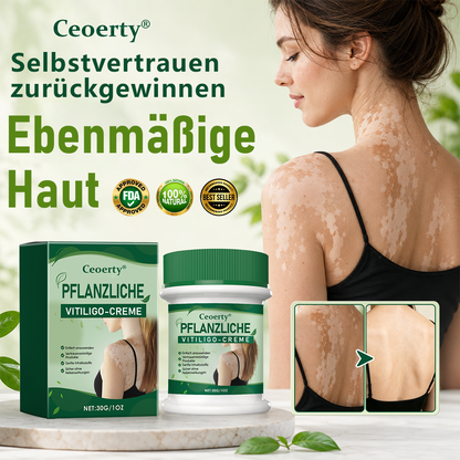 Ceoerty® Kräuter-Vitiligo-Creme