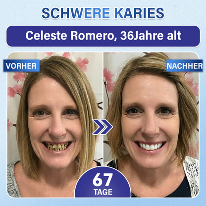 Ceoerty® Zahn- und Zahnfleischpflege – schnell lösliches Mikronadel-Pflaster✨