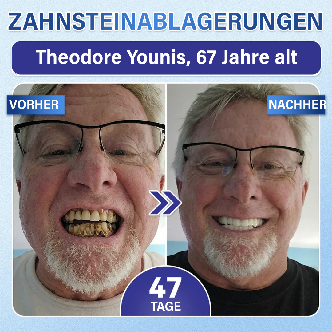 Ceoerty® Zahn- und Zahnfleischpflege – schnell lösliches Mikronadel-Pflaster✨