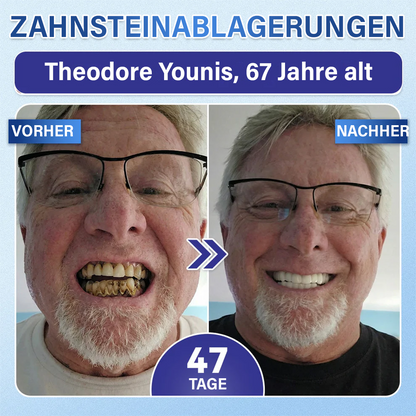 Ceoerty® Zahn- und Zahnfleischpflege – schnell lösliches Mikronadel-Pflaster✨