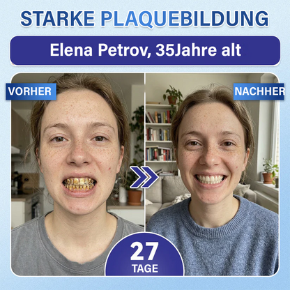 Ceoerty® Zahn- und Zahnfleischpflege – schnell lösliches Mikronadel-Pflaster✨