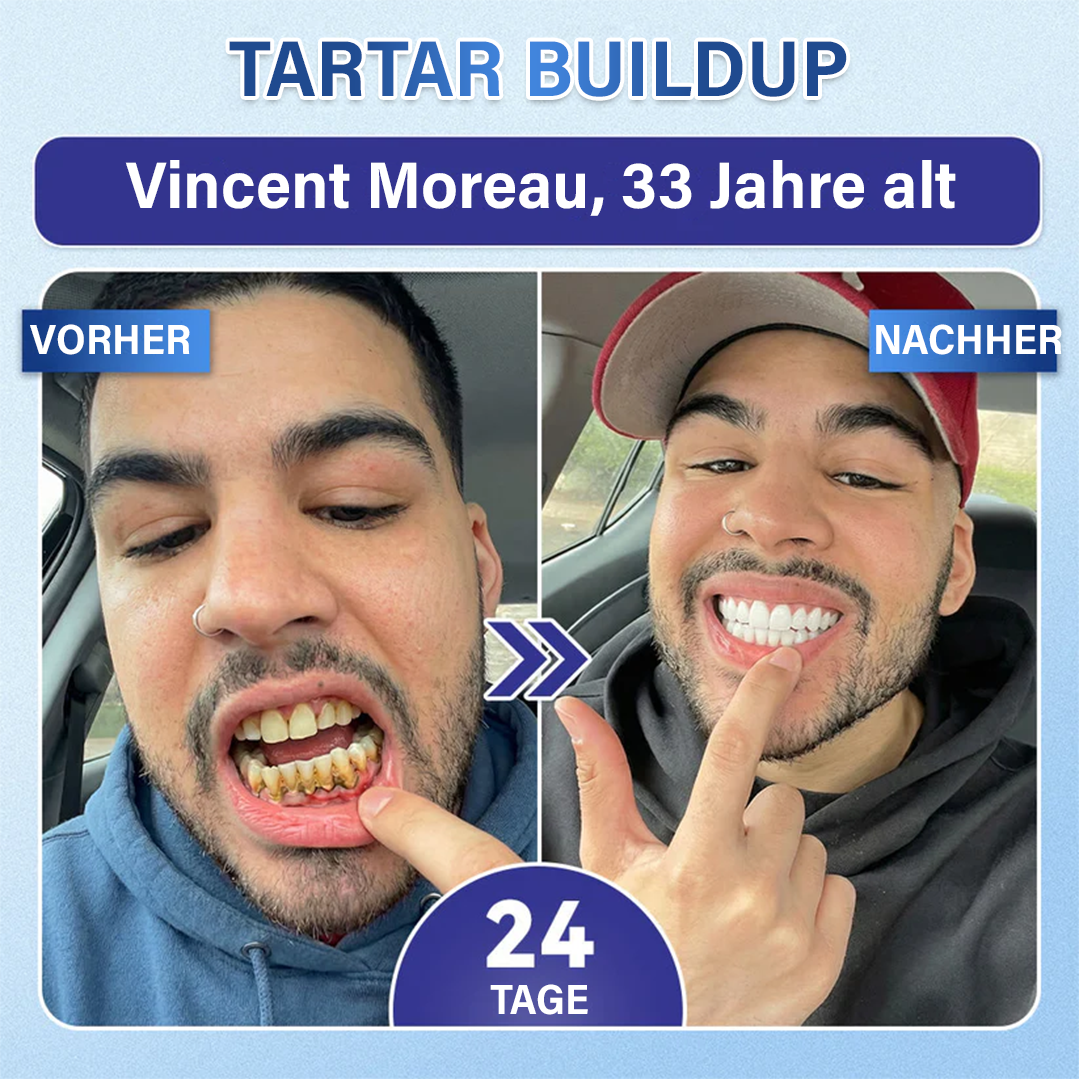 Ceoerty® Zahn- und Zahnfleischpflege – schnell lösliches Mikronadel-Pflaster✨