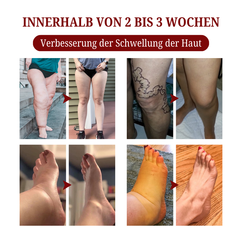Biancat™  SwellCare Lymphatische Massagecreme