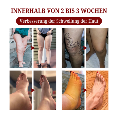 Biancat™  SwellCare Lymphatische Massagecreme