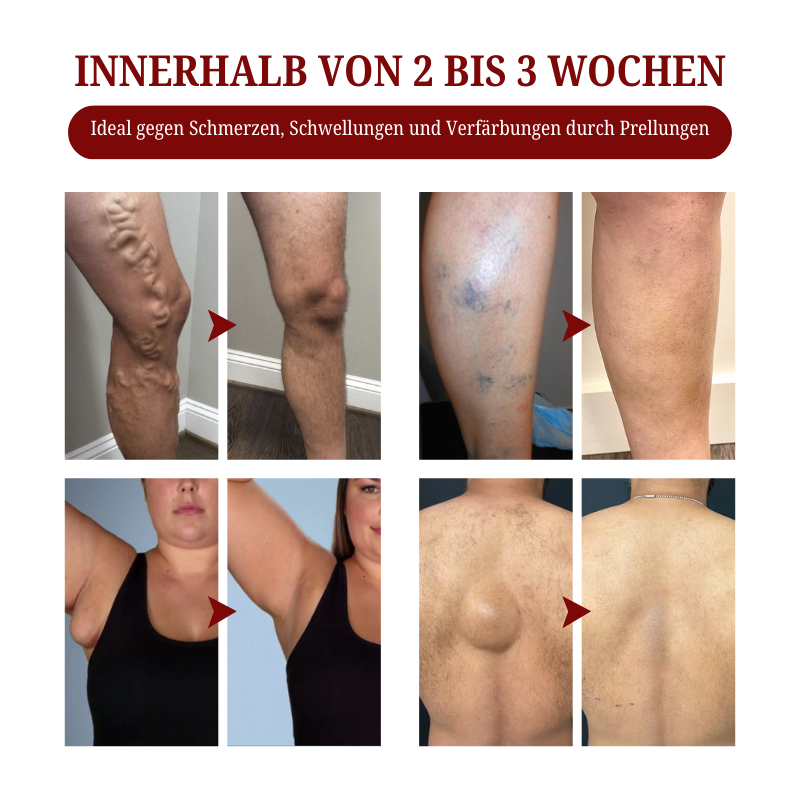 Biancat™  SwellCare Lymphatische Massagecreme