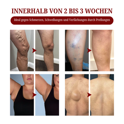 Biancat™  SwellCare Lymphatische Massagecreme