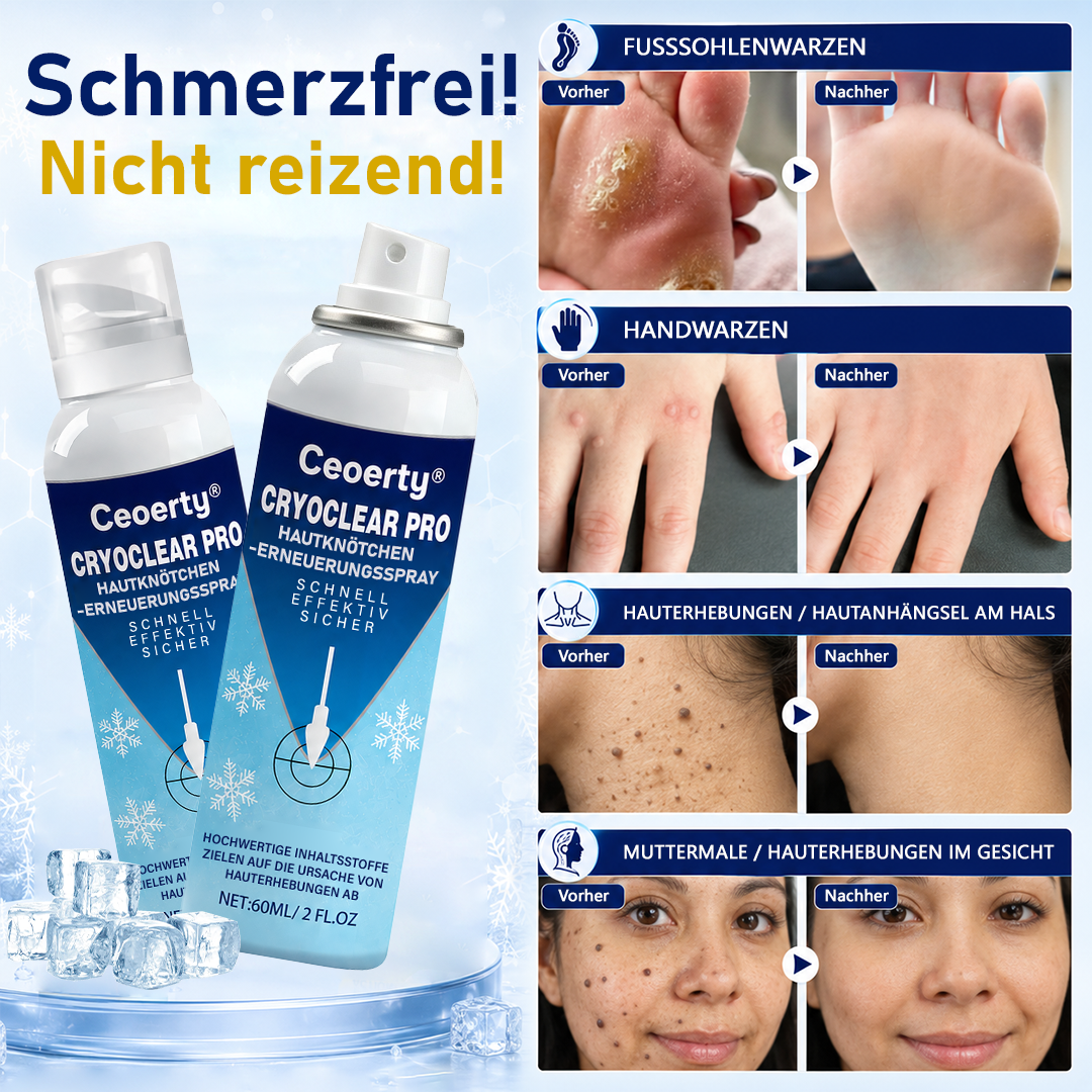 Ceoerty® CryoClear Pro Hauterneuerungs-Spray gegen Hautunebenheiten