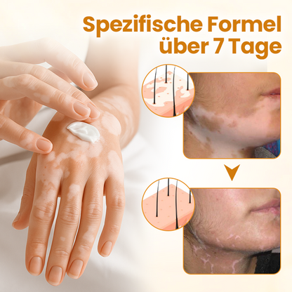 Timilk® VitiCalm Bienengift-Creme-upsell YQ