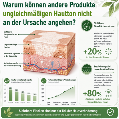 Ceoerty® Kräuter-Vitiligo-Creme