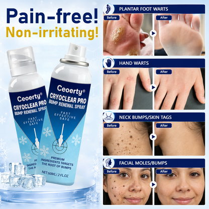 Ceoerty® CryoClear Pro Hauterneuerungs-Spray gegen Hautunebenheiten