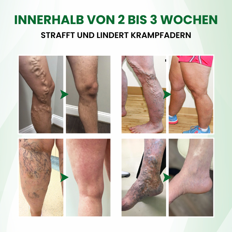 Timilk® VariPoint™ Phyto-Vaskuläres Mikronadel-Pflaster