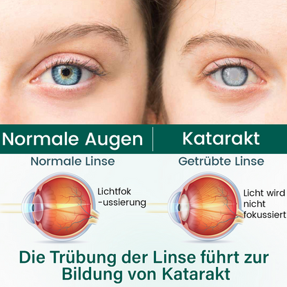 Ceoerty® OptiClear Nano Augenroller-Serum