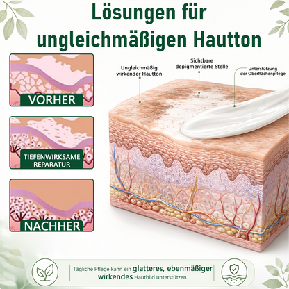 Ceoerty® Kräuter-Vitiligo-Creme