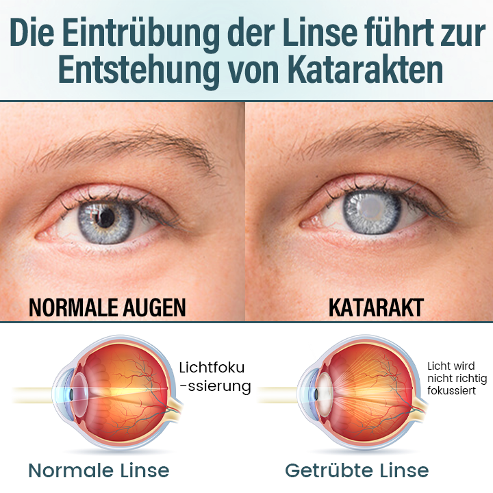 Timilk® OptiFusion Nano Augentropfen-Serum (A)