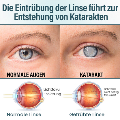 Timilk® OptiFusion Nano Augentropfen-Serum (A)