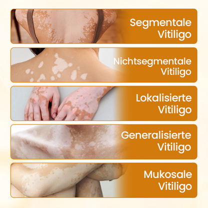 Timilk® VitiCalm Bienengift-Creme
