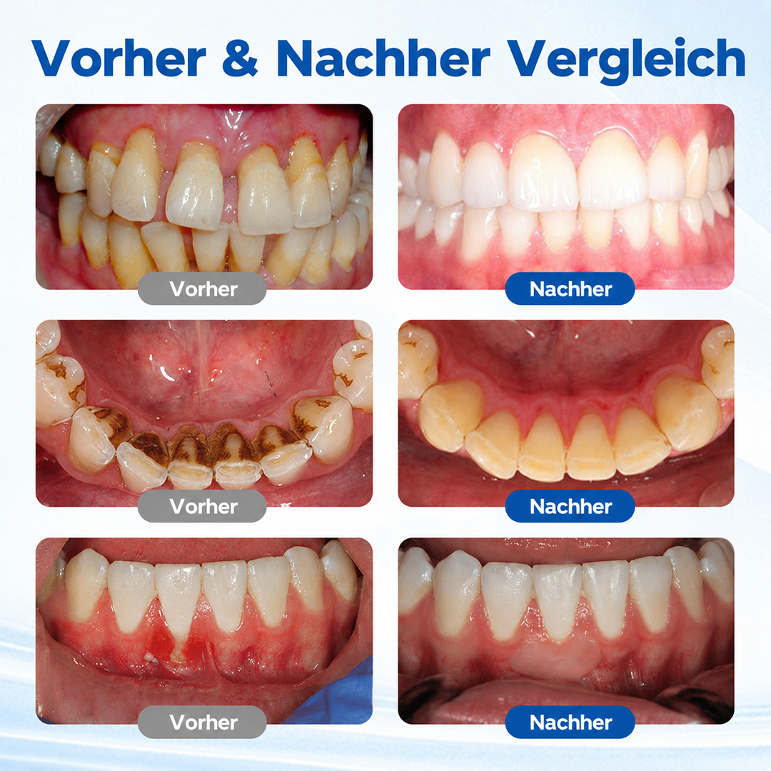 Biancat® GumBiome Zahnfleisch-Regenerationsgel