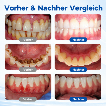 Biancat® GumBiome Zahnfleisch-Regenerationsgel
