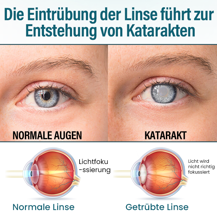Timilk® OptiRegen Nano-Augenserum