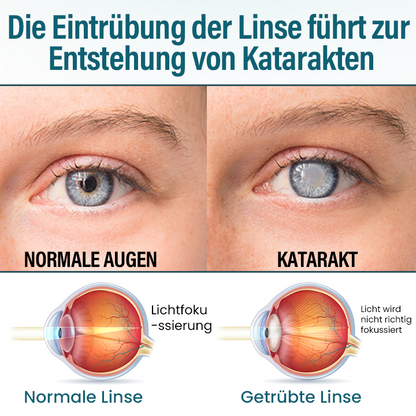 Timilk® OptiRegen Nano-Augenserum