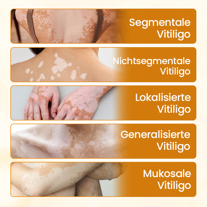 Timilk® VitiCalm Bienengift-Creme-upsell YQ
