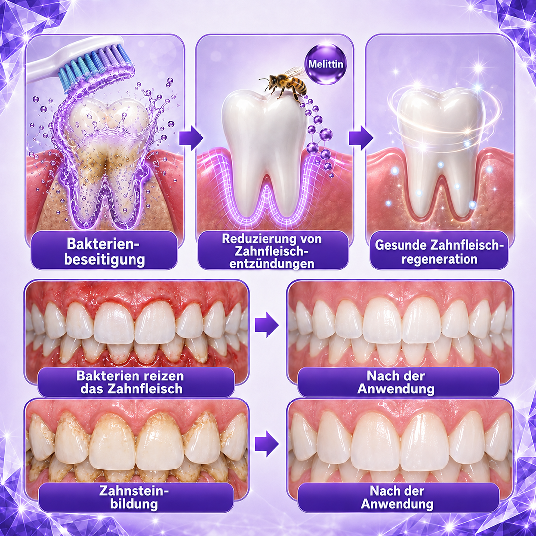 Ceoerty® Gingivitis & Parodontitis Pflege-Zahnpasta-