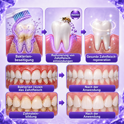 Ceoerty® Gingivitis & Parodontitis Pflege-Zahnpasta-