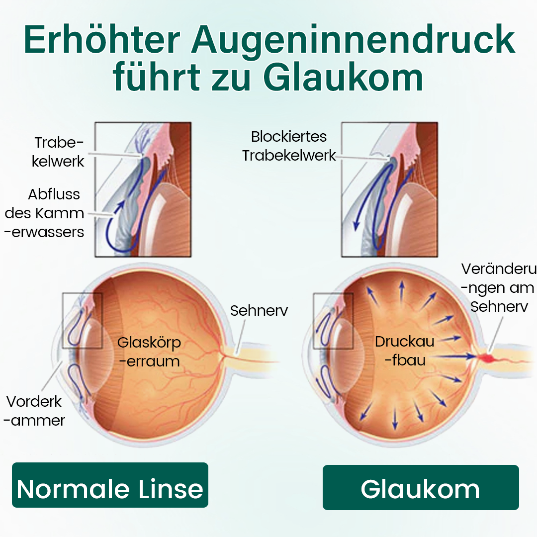 Ceoerty® OptiClear Nano Augenroller-Serum