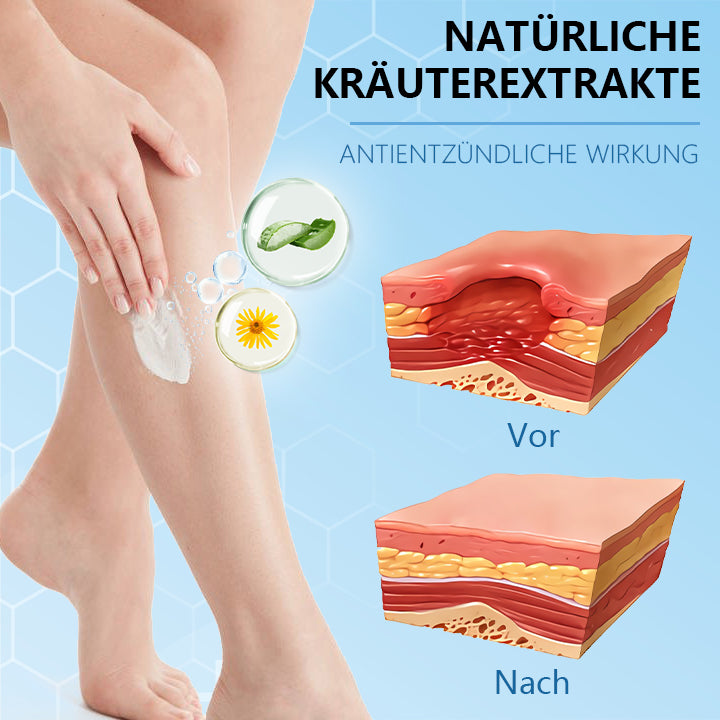 Ceoerty™ Krampfaderncreme mit Hydrogel
