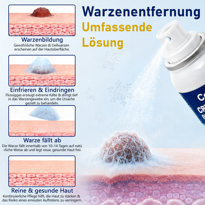 Ceoerty® CryoClear Pro Hauterneuerungs-Spray gegen Hautunebenheiten