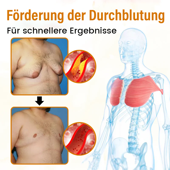 Timilk® VenomDefine Bienengift-Gynäkomastieöl für Männer (A)
