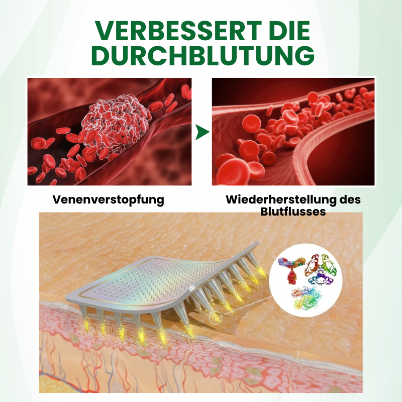 Timilk® VariPoint™ Phyto-Vaskuläres Mikronadel-Pflaster
