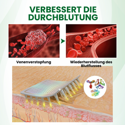 Timilk® VariPoint™ Phyto-Vaskuläres Mikronadel-Pflaster