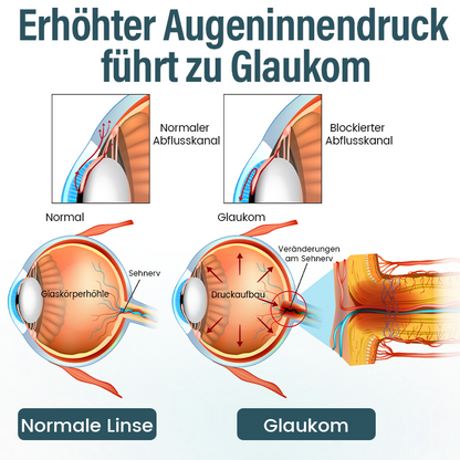 Timilk® OptiFusion Nano Augentropfen-Serum (A)