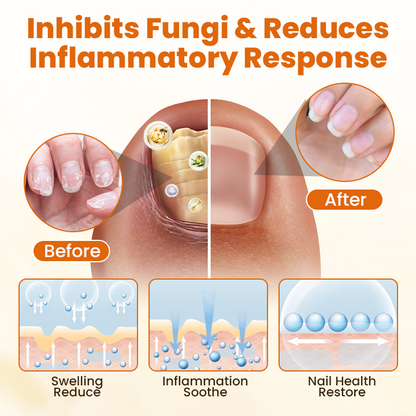 Timilk® FungiBee Fortschrittliches Nagelreparatur-Spray⚕️