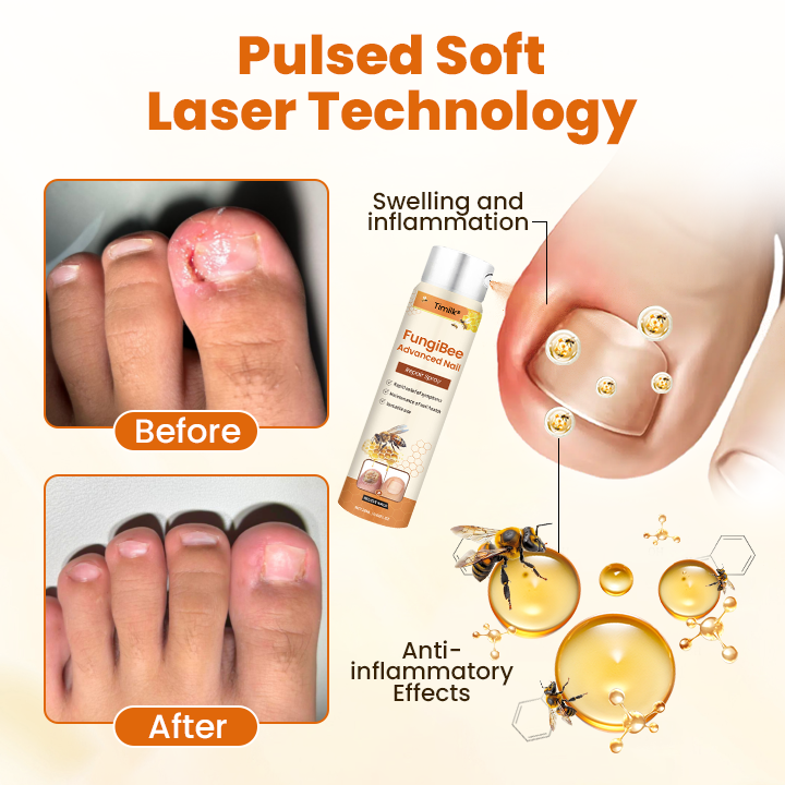 Timilk® FungiBee Fortschrittliches Nagelreparatur-Spray⚕️