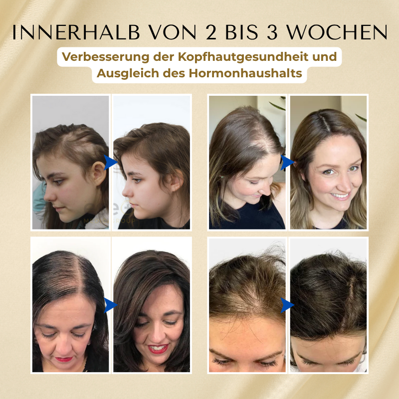 Timilk® VitaStrand Biotin Haarwachstumsspray-